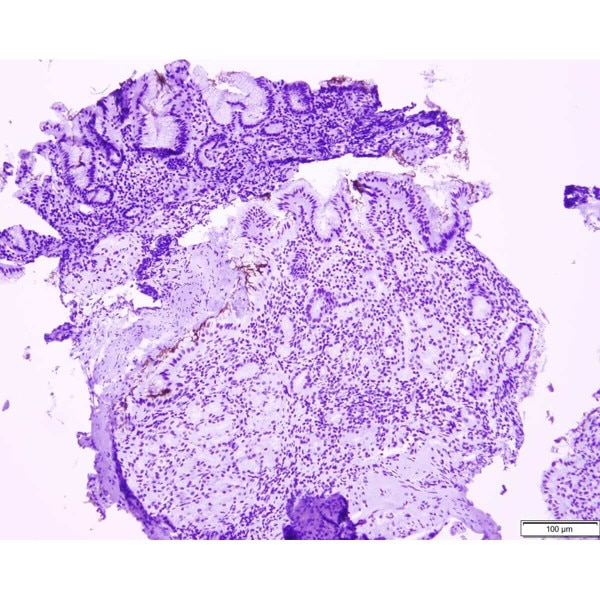 Control Slide, IHC, Helicobacter